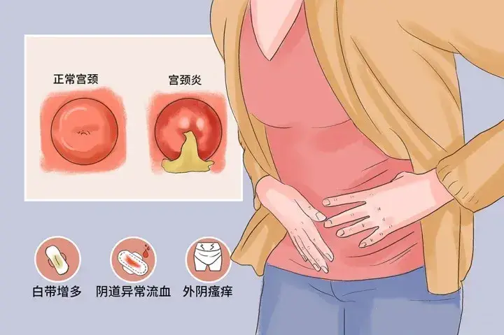 妇科炎症中医怎么调理？贡方堂TCM丘保润有妙方专治白带病！