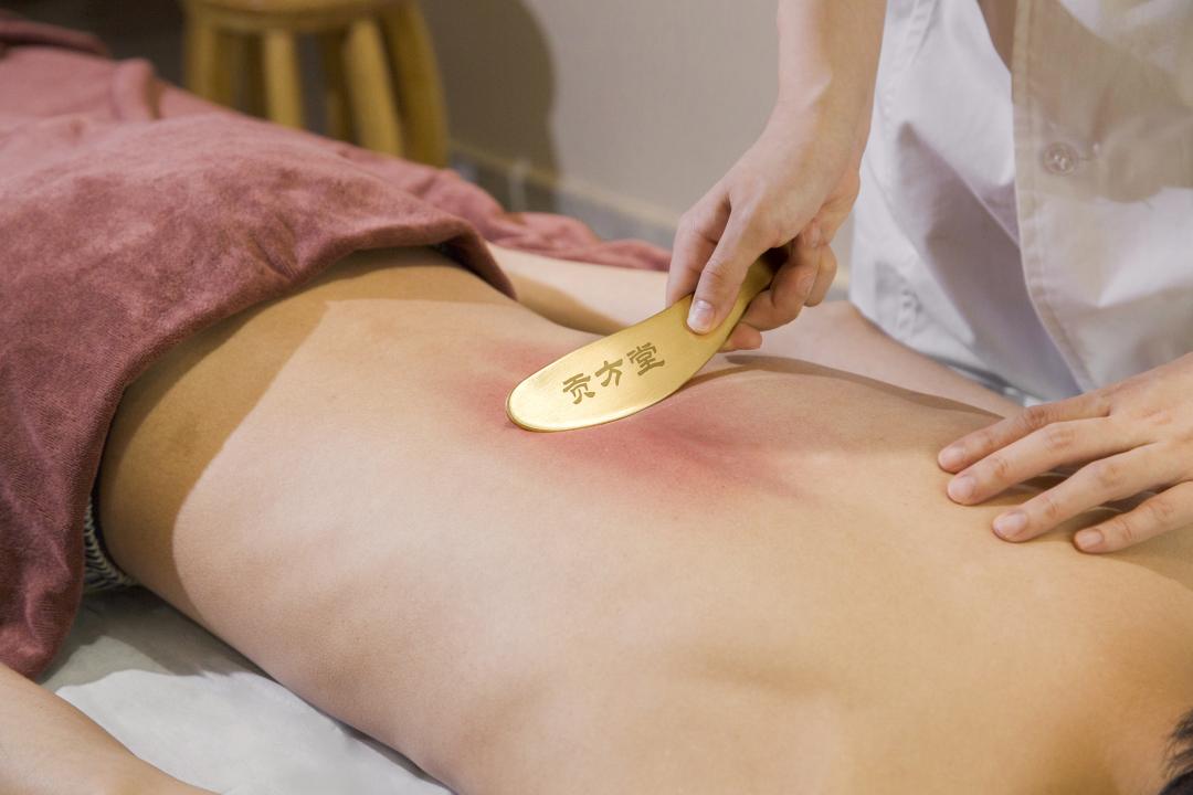 Experience Authentic Singaporean Gua Sha Therapy — Gong Fang Tang TCM!