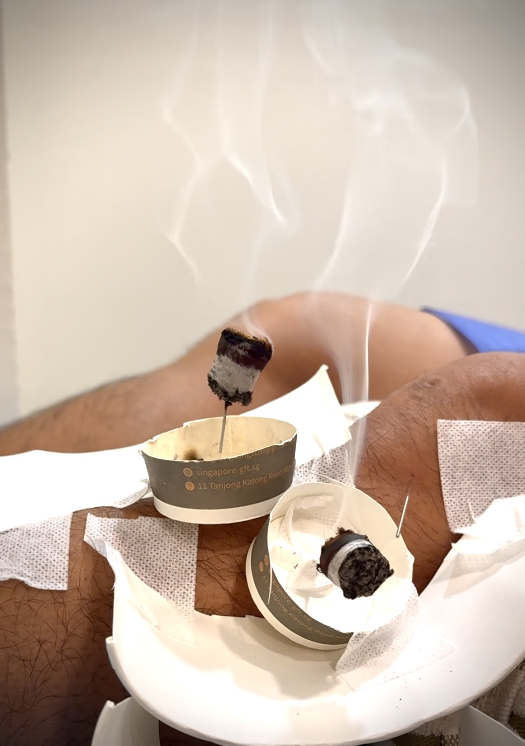 Got a Sprained Ankle in Singapore? Kong Fang Tong TCM Has Your Solution!