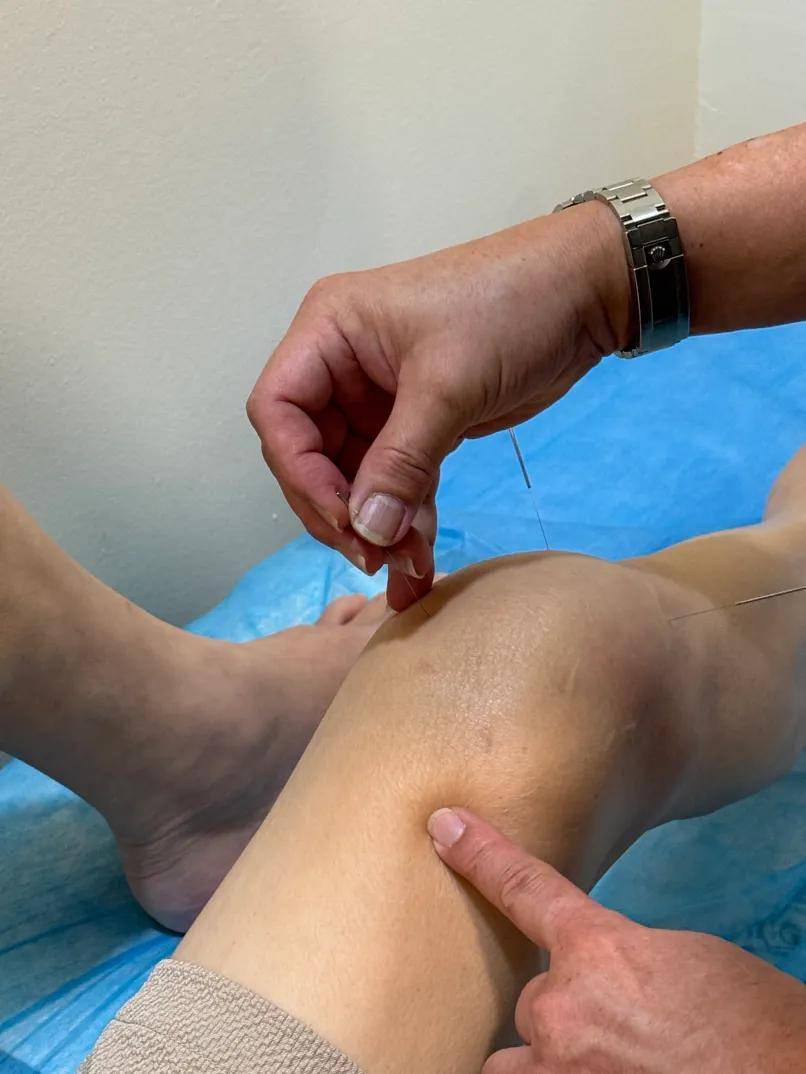 【医案】风寒湿痹型双膝肿痛如何治疗？新加坡贡方堂TCM丘保润妙方祛风散寒、除湿通络！