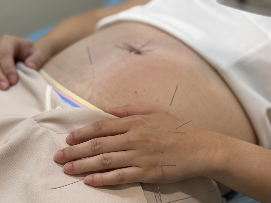 Stomach Pain Singapore 新加坡胃痛治疗