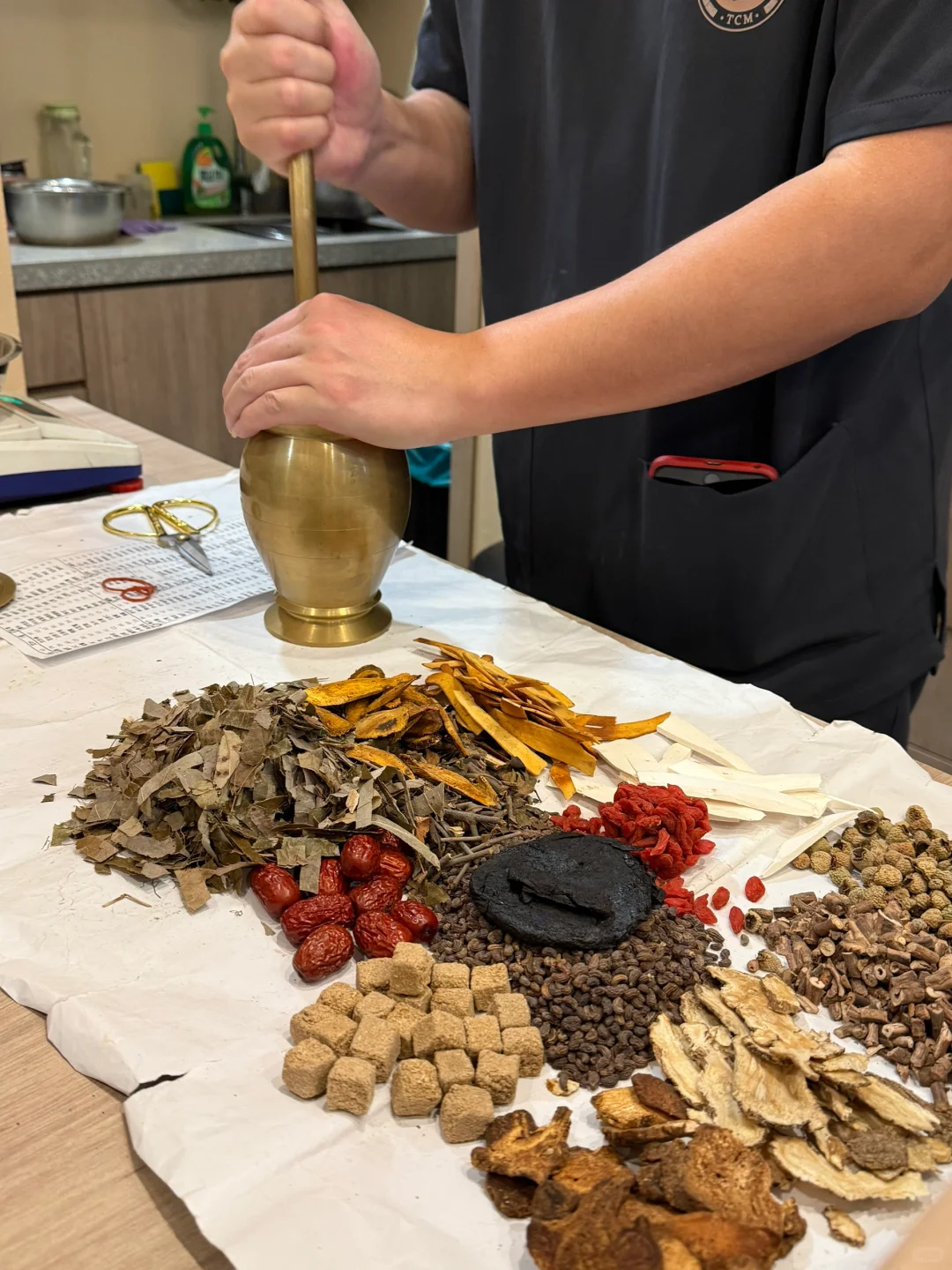 斑秃是什么原因造成的怎么治疗？新加坡看斑秃的中医哪家最好？