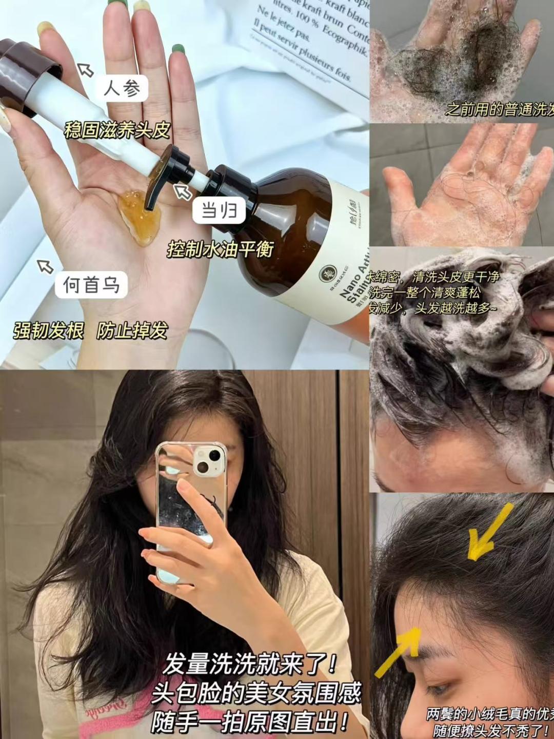 头发出油、细软塌怎么调理？新加坡贡方堂TCM皮肤科中医内调外洗，防脱固发！