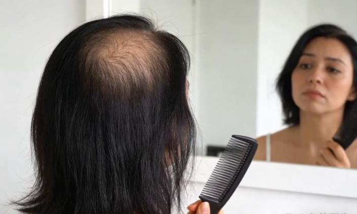 一洗头就掉一大把?脱发别光换洗发水了!GFT纳米头疗用草本养回好发量 一洗头就掉一大把?脱发别光换洗发水了!GFT纳米头疗用草本养回好发量